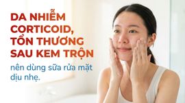 Da nhiễm corticoid, tổn thương sau kem trộn: nên dùng sữa rửa mặt dịu nhẹ