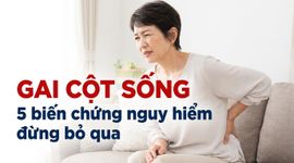 Gai cột sống: 5 biến chứng nguy hiểm đừng bỏ qua