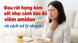 Đau rát họng kèm sốt nhẹ: cảnh báo đỏ viêm amidan và cách xử lý nhanh