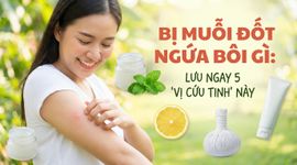 Bị muỗi đốt ngứa bôi gì: lưu ngay 5 "vị cứu tinh" này
