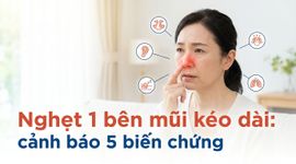 Nghẹt 1 bên mũi kéo dài: cảnh báo 5 biến chứng