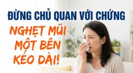 Đừng chủ quan với chứng nghẹt mũi một bên kéo dài!