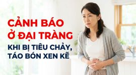 Cảnh báo ở đại tràng khi bị tiêu chảy, táo bón xen kẽ