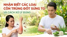 Nhận biết các loại côn trùng đốt sưng to và cách xử lý đúng