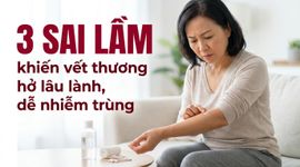 3 sai lầm khiến vết thương hở lâu lành, dễ nhiễm trùng