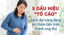 5 dấu hiệu "tố cáo" bệnh đại tràng đang âm thầm tiến triển thành ung thư