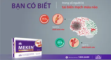 Bạn có thực sự hiểu tai biến mạch máu não là gì?