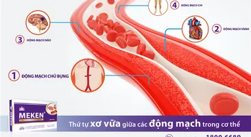 MẠCH MÁU NÀO DỄ BỊ XƠ VỮA ĐỘNG MẠCH NHẤT?