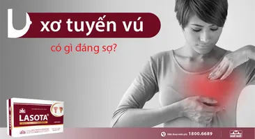 U xơ tuyến vú có gì đáng sợ?