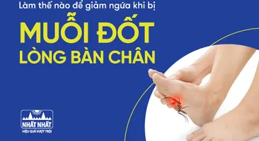 Làm thế nào để giảm ngứa khi bị muỗi đốt lòng bàn chân?