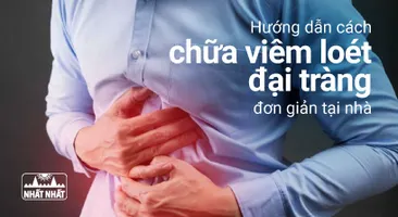 Hướng dẫn cách chữa viêm loét đại tràng đơn giản tại nhà