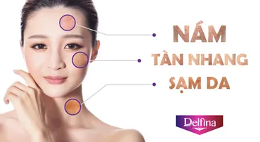 Tuyệt chiêu dưỡng da mặt sau sinh "đẹp mòn con mắt"
