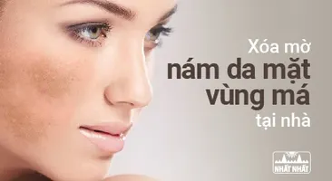 Xóa mờ nám da mặt vùng má tại nhà bằng phương pháp Đông y