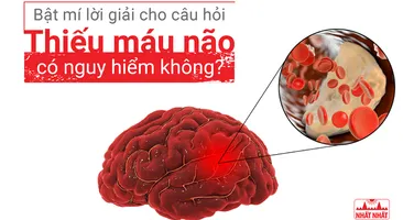 Bật mí lời giải cho câu hỏi “Thiếu máu não có nguy hiểm không?”
