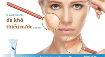 Bí quyết chăm sóc da khô thiếu nước hiệu quả