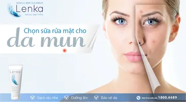 Bật mí cách chọn sữa rửa mặt cho da mụn tốt