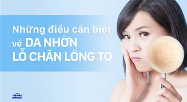 Những điều cần biết về da dầu lỗ chân lông to