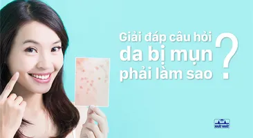 Giải đáp câu hỏi da bị mụn phải làm sao?
