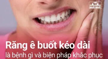 Răng ê buốt kéo dài nguy hiểm hơn nhiều người nghĩ
