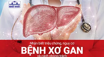 Nhận biết triệu chứng, nguy cơ bệnh xơ gan và cách phòng tránh