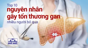 Top 10 nguyên nhân gây tổn thương gan nhiều người bỏ qua