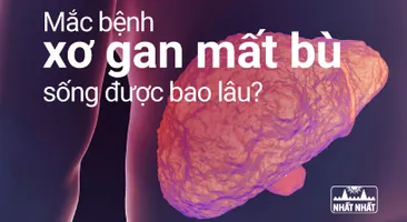Mắc bệnh xơ gan mất bù thì sống được bao lâu?