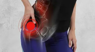 Bệnh thoái hóa khớp háng có chữa khỏi hoàn toàn không?
