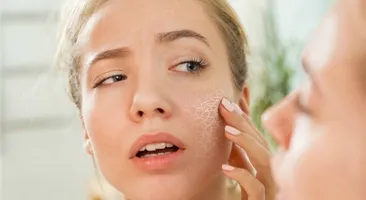 Cách cải thiện độ ẩm của da vào mùa hanh khô