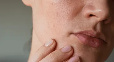 Da khô mùa đông: Làm sao để da mềm mịn hơn?