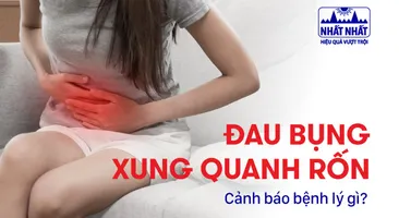 Đau bụng xung quanh rốn: Cảnh báo bệnh lý gì?