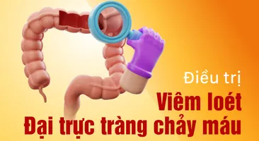 Viêm loét đại trực tràng chảy máu có nguy hiểm không? 