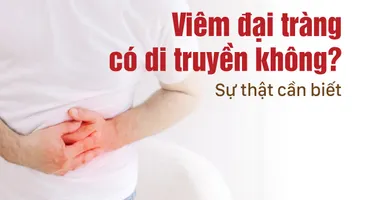 Viêm đại tràng có di truyền không? Sự thật cần biết