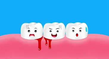Đánh răng chảy máu chân răng: Nguyên nhân và cách khắc phục