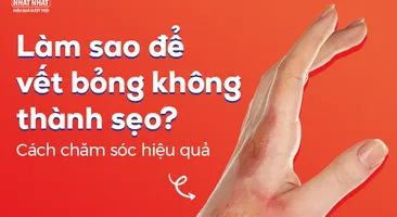 Làm sao để vết bỏng không thành sẹo? Cách chăm sóc hiệu quả