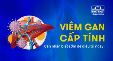Viêm gan cấp tính: Cần nhận biết sớm để điều trị ngay!