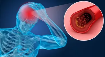 Hiện tượng thiếu máu lên não có nguy hiểm không?
