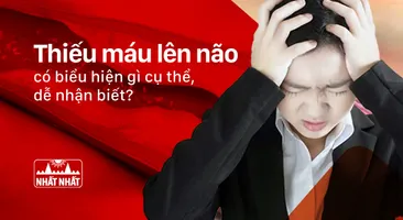 Thiếu máu lên não có biểu hiện gì cụ thể, dễ nhận biết?