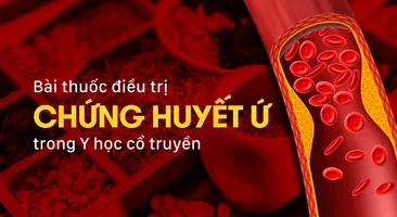 Bài thuốc điều trị chứng huyết ứ trong Y học cổ truyền