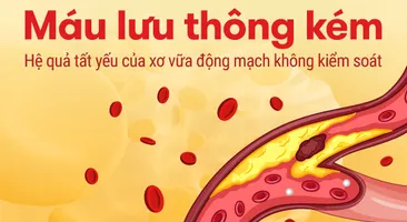 Máu lưu thông kém - Hệ quả tất yếu của xơ vữa động mạch không kiểm soát