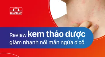 Review kem thảo dược giảm nhanh nổi mẩn ngứa ở cổ