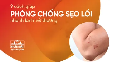9 cách giúp phòng chống sẹo lồi, nhanh lành vết thương