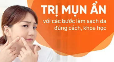 Trị mụn ẩn với các bước làm sạch da đúng cách, khoa học