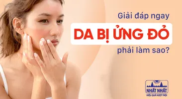 Giải đáp ngay: Da bị ửng đỏ phải làm sao?