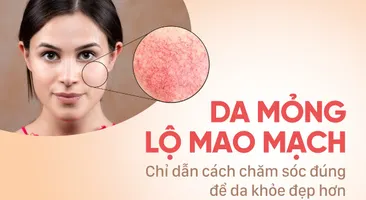 Da mỏng lộ mao mạch: Chỉ dẫn cách chăm sóc đúng để da khỏe đẹp hơn
