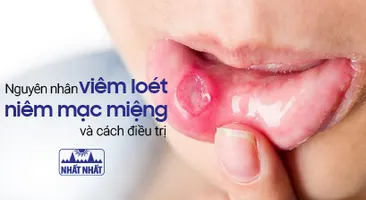 Viêm loét niêm mạc miệng sẽ không còn đáng sợ nếu biết cách!