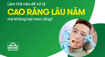 Làm thế nào để xử lý cao răng lâu năm mà không hại men răng?