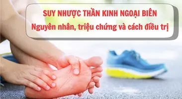 Suy nhược thần kinh ngoại biên: Nguyên nhân, triệu chứng và cách điều trị