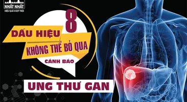 8 Dấu hiệu không thể bỏ qua cảnh báo ung thư gan