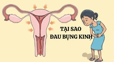 Tại sao đau bụng kinh? Nguyên nhân và cách cải thiện