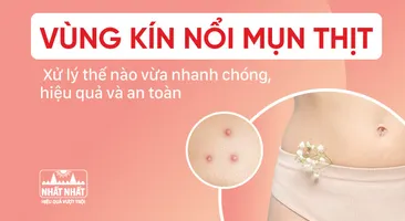 Vùng kín nổi mụn thịt: Hướng dẫn cách xử trí nhanh 